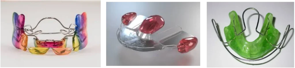 Ortodonzia mobile