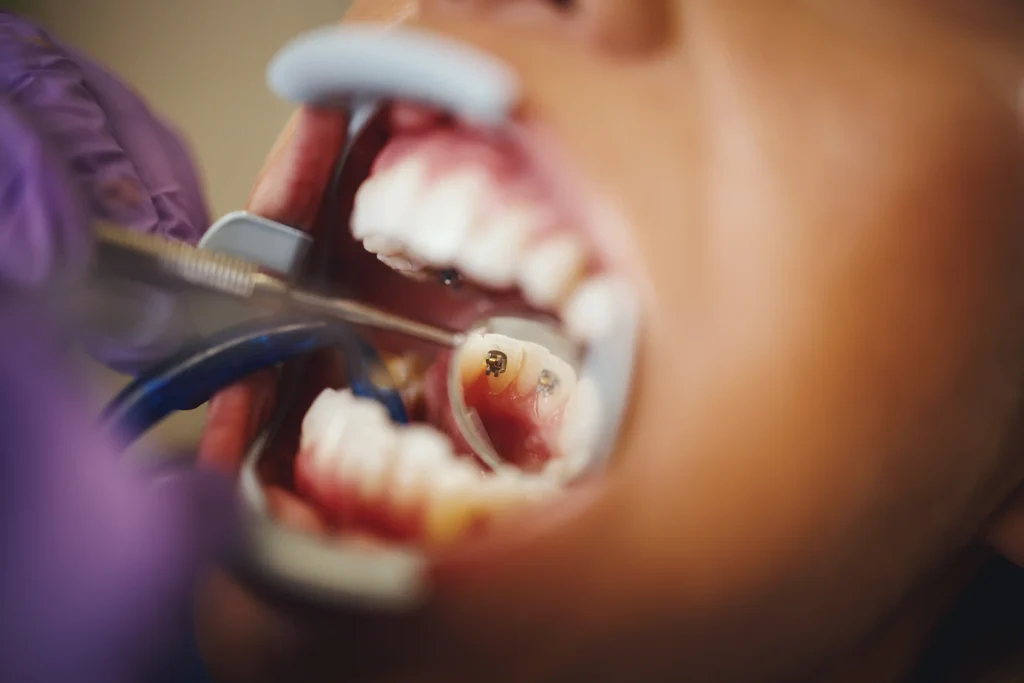 Odontoiatria pediatrica