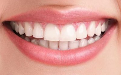 Igiene e Sbiancamento Dentale